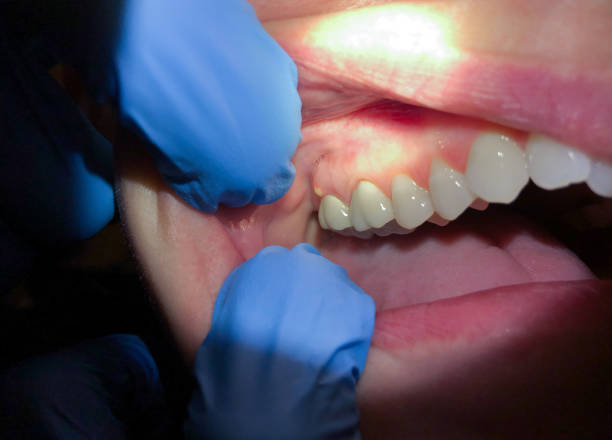 Best Emergency Dentist for Special Needs Patients in Glassmanor, MD